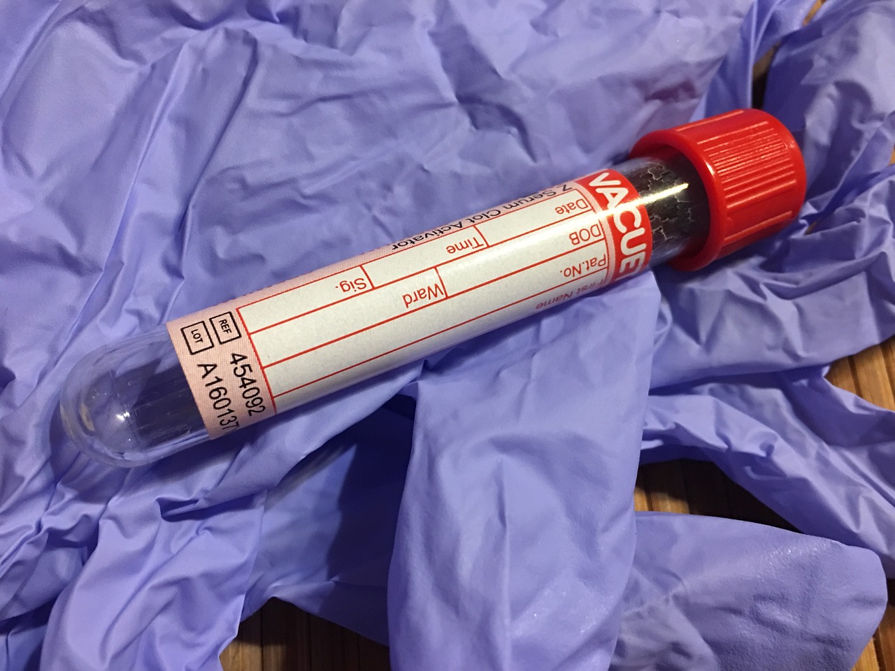 test-tube-1761832_1280
