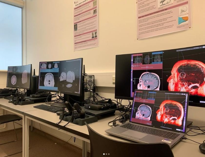 Ποιος είναι ο Αναστάσιος Γιαμουριάδης, ο νευροχειρουργός που αφαιρεί όγκους από τα φρύδια 2 Ποιος είναι ο Αναστάσιος Γιαμουριάδης, ο νευροχειρουργός που αφαιρεί όγκους από τα φρύδια