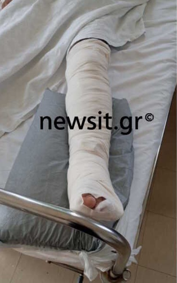 «Τρελάθηκε, πάτησε γκάζι και έσκασε πάνω μας» λένε τα θύματα στο Πολυδένδρι - «Ήταν φίλος ενός πρώην μου»