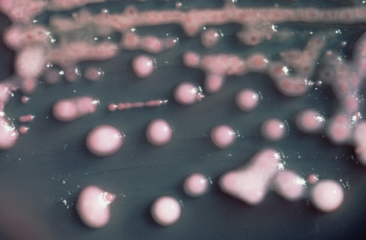 Klebsiella_pneumoniae_01