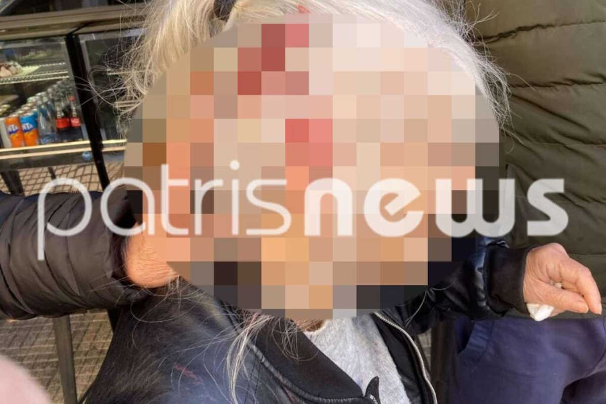 Λήστεψαν μια ηλικιωμένη κατά τη διάρκεια της ημέρας στον Πύργο και την οδήγησαν στο νοσοκομείο