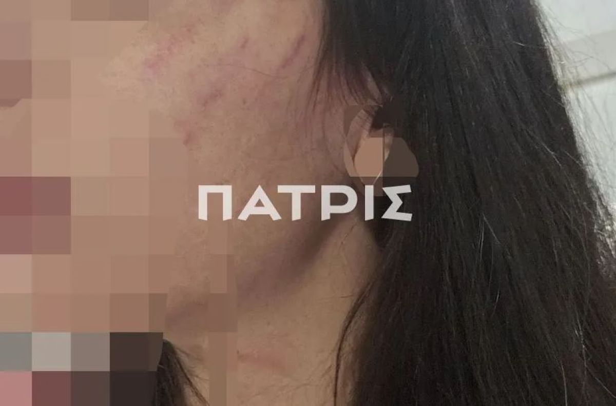 Πήγαν για τριήμερη εκδρομή στην Έδεσσα και την έστειλε στο νοσοκομείο με κατάγματα πλευρών και χτυπήματα