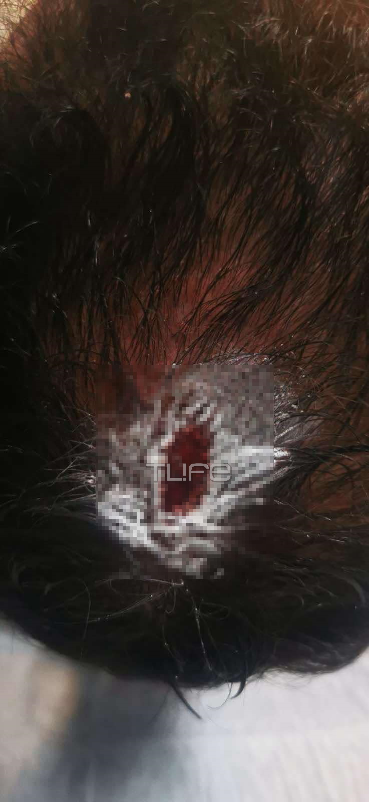 Τι δηλώνει ο Στέφανος Κοκολογιάννης που γλίτωσε από θαύμα μετά τους πυροβολισμούς – Οι ανατριχιαστικές εικόνες μετά τον τραυματισμό 4 Τι δηλώνει ο Στέφανος Κοκολογιάννης που γλίτωσε από θαύμα μετά τους πυροβολισμούς – Οι ανατριχιαστικές εικόνες μετά τον τραυματισμό