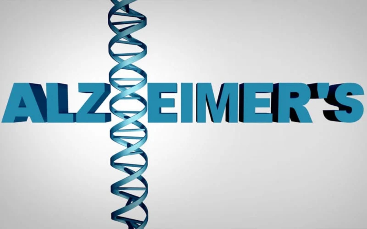 Alzheimer-2
