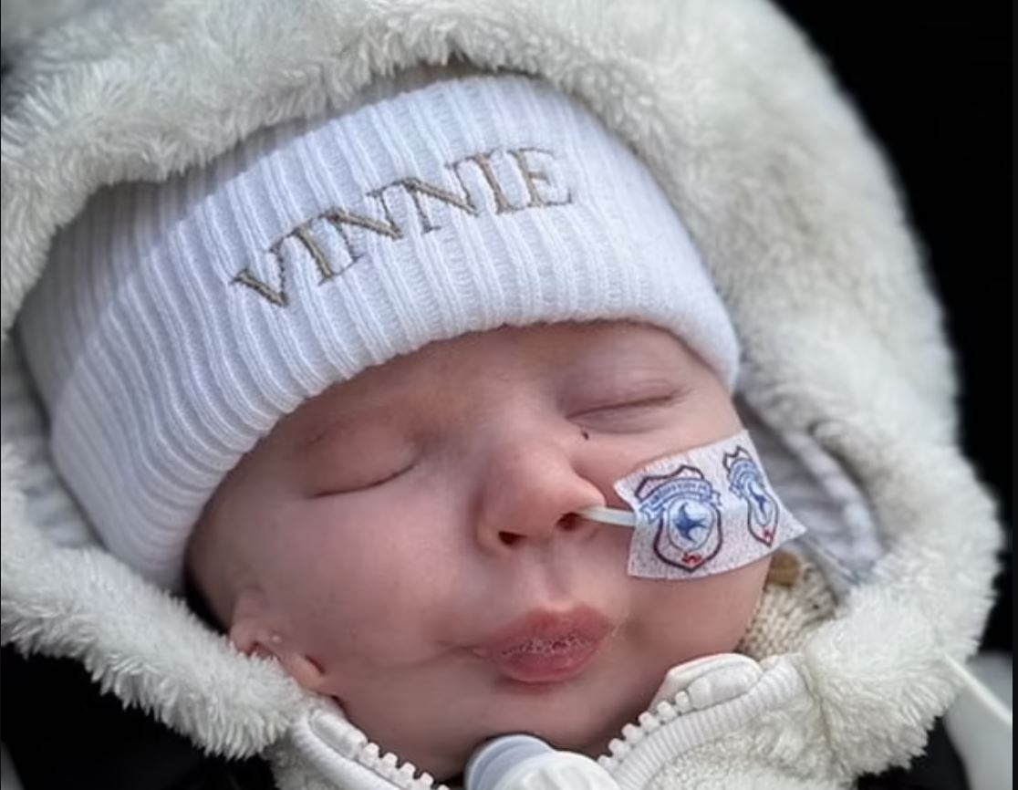 Μωρό γεννήθηκε έχοντας το δεξί του αυτί στο μάγουλο – Το σπάνιο σύνδρομο από το οποίο πάσχει 6 ΜΩΡΟ ΑΥΤΙ