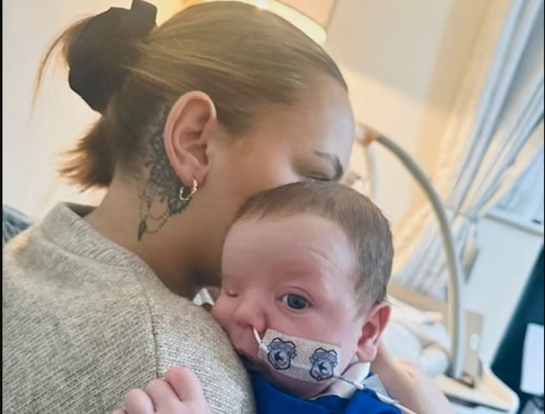 Μωρό γεννήθηκε έχοντας το δεξί του αυτί στο μάγουλο – Το σπάνιο σύνδρομο από το οποίο πάσχει 5 ΜΩΡΟ ΑΥΤΙ