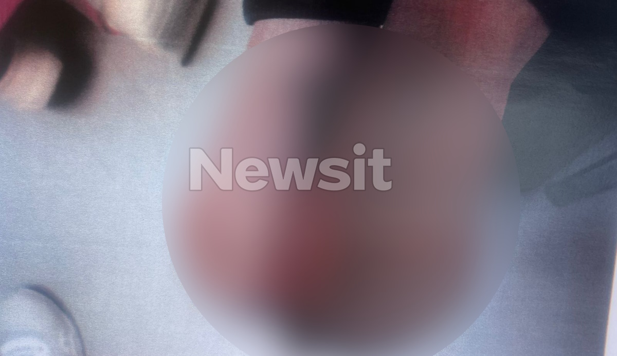 Λάρισα: Συγκλονιστικές εικόνες από τα βασανιστήρια με τσιγάρα στα κορμιά των παιδιών – «Περίπου 20 λεπτά μας έκαιγε και μας χτυπούσε»