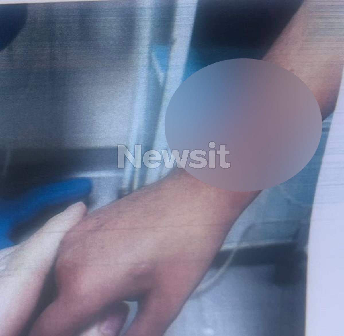 Λάρισα: Συγκλονιστικές εικόνες από τα βασανιστήρια με τσιγάρα στα κορμιά των παιδιών – «Περίπου 20 λεπτά μας έκαιγε και μας χτυπούσε»