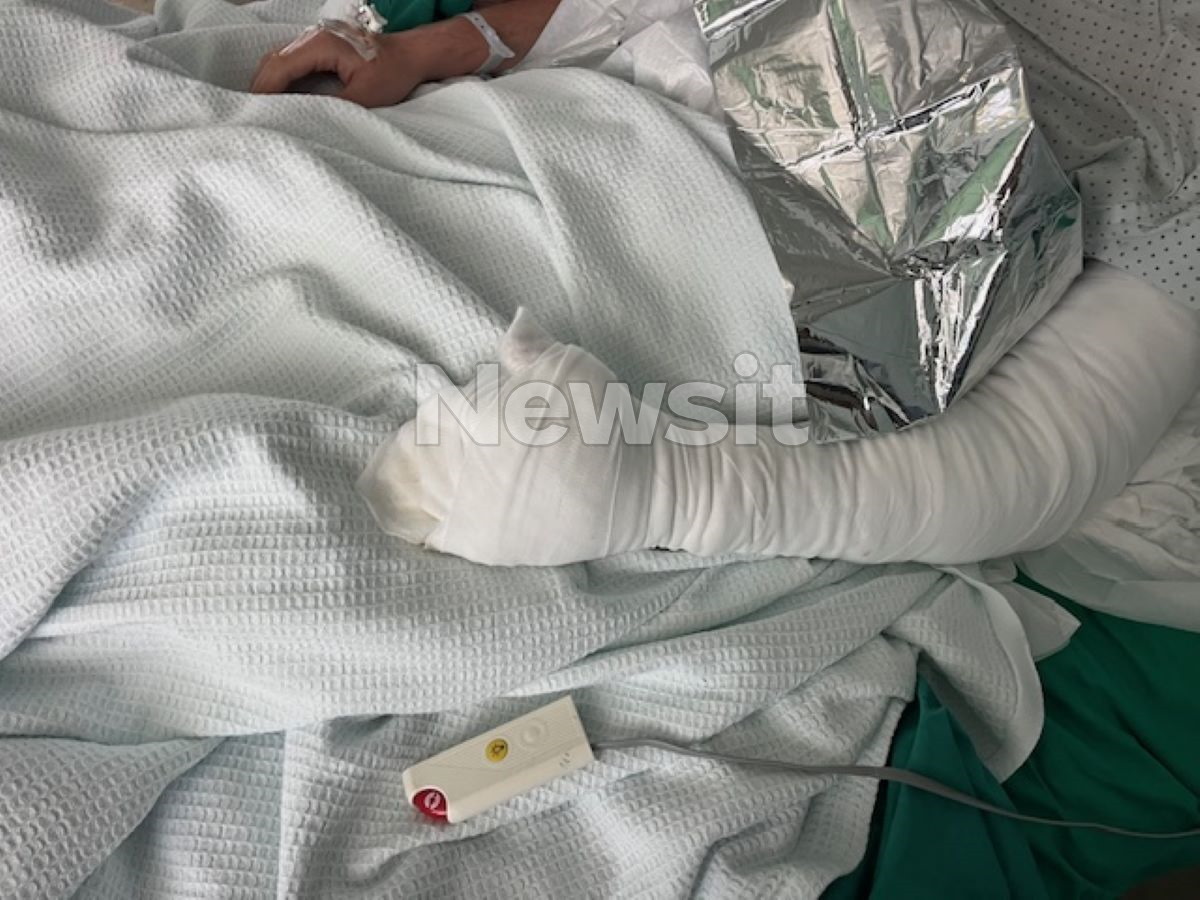 Σέρρες: «Έτρεχε αίμα από το μάτι μου, τυφλώθηκα», συγκλονίζει ο 19χρονος ψυκτικός που τραυματίστηκε από την έκρηξη στο νοσοκομείο 4 Ο νεαρός ψυκτικός φέρει τραύματα και στο αριστερό του χέρι