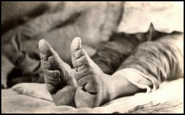 21 παραμελημένα αντικείμενα τόσο αλλόκοτα που προκαλούν ρίγη! (φωτό)