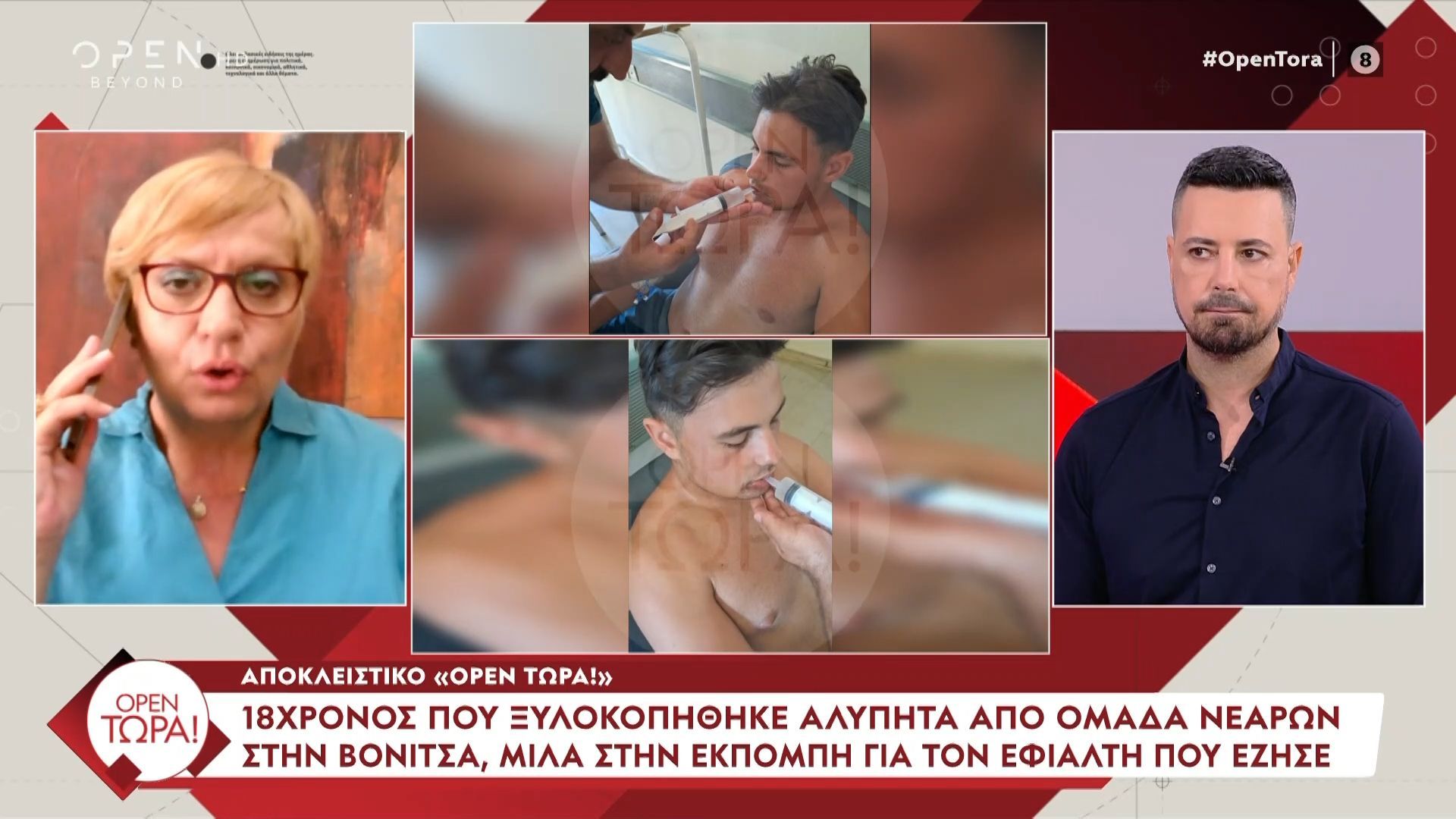 Αποκλειστικό-Open-Τώρα-18χρονος-ξυλοκοπήθηκε-άγρια-από-ομάδα-νεαρών-στη-Βόνιτσα
