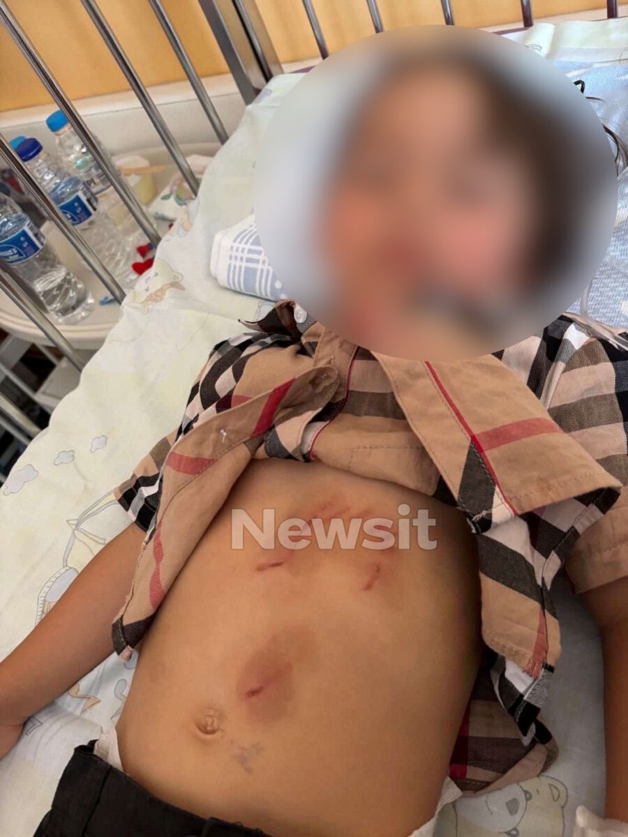 Λύκος δάγκωσε 3χρονο από τη Βουλγαρία στη Χαλκιδική