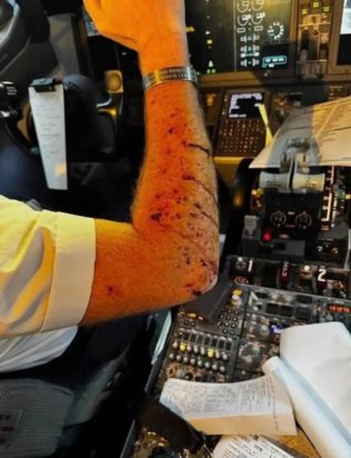 Μυστηριώδες αντικείμενο προσέκρουσε σε πιλοτήριο αεροσκάφους, τραυματίζοντας τον πιλότο – Δείτε τις εικόνες