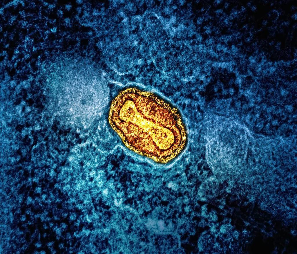national-institute-of-allergy-and-infectious-diseases-cTqjQnqXnY8-unsplash-1-1024x875-1
