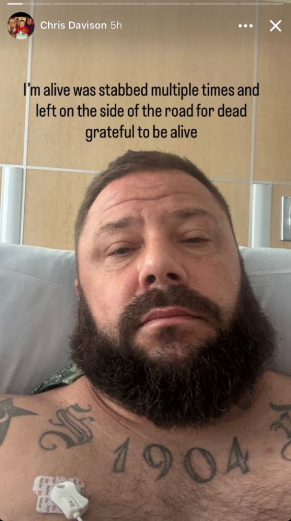 38χρονος πατέρας δέχθηκε επίθεση με μαχαίρι καθ' οδόν για γιορτή Halloween – Ένα αυτοκόλλητο δεινοσαύρου των παιδιών του τον έσωσε 4 38χρονος πατέρας δέχθηκε επίθεση με μαχαίρι καθ' οδόν για γιορτή Halloween – Ένα αυτοκόλλητο δεινοσαύρου των παιδιών του τον έσωσε