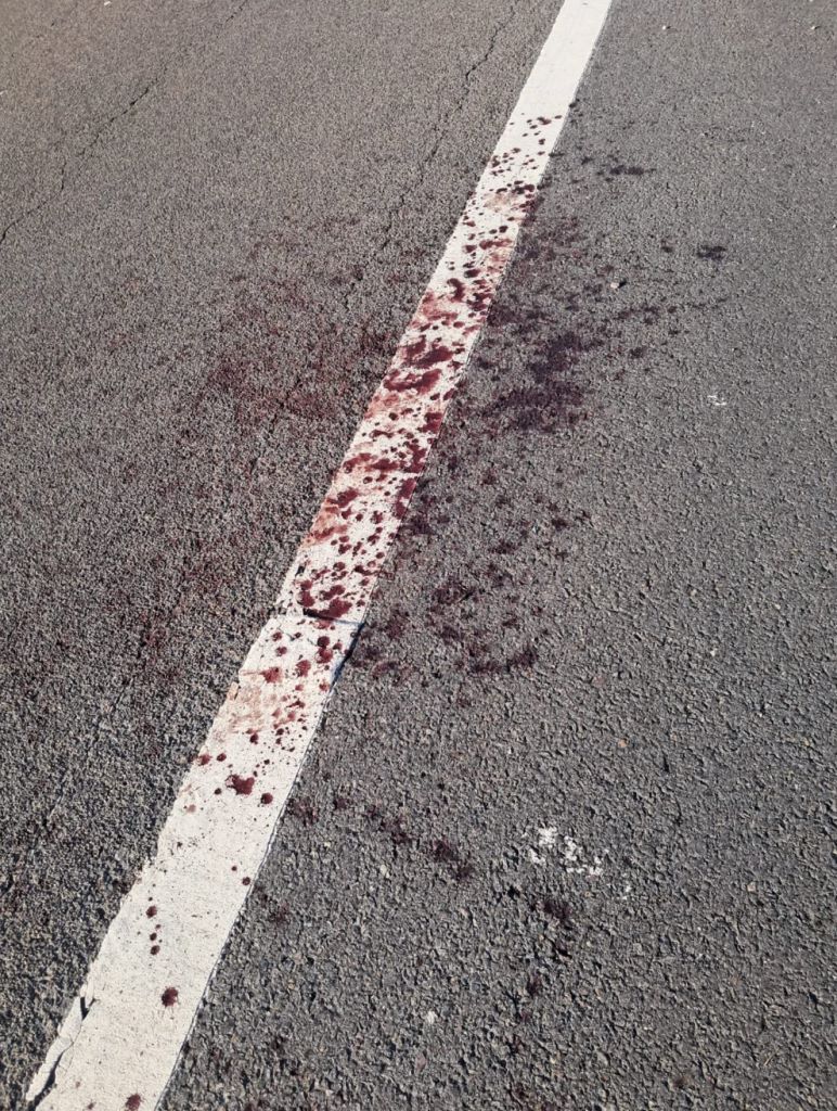 38χρονος πατέρας δέχθηκε επίθεση με μαχαίρι καθ' οδόν για γιορτή Halloween – Ένα αυτοκόλλητο δεινοσαύρου των παιδιών του τον έσωσε 5 38χρονος πατέρας δέχθηκε επίθεση με μαχαίρι καθ' οδόν για γιορτή Halloween – Ένα αυτοκόλλητο δεινοσαύρου των παιδιών του τον έσωσε