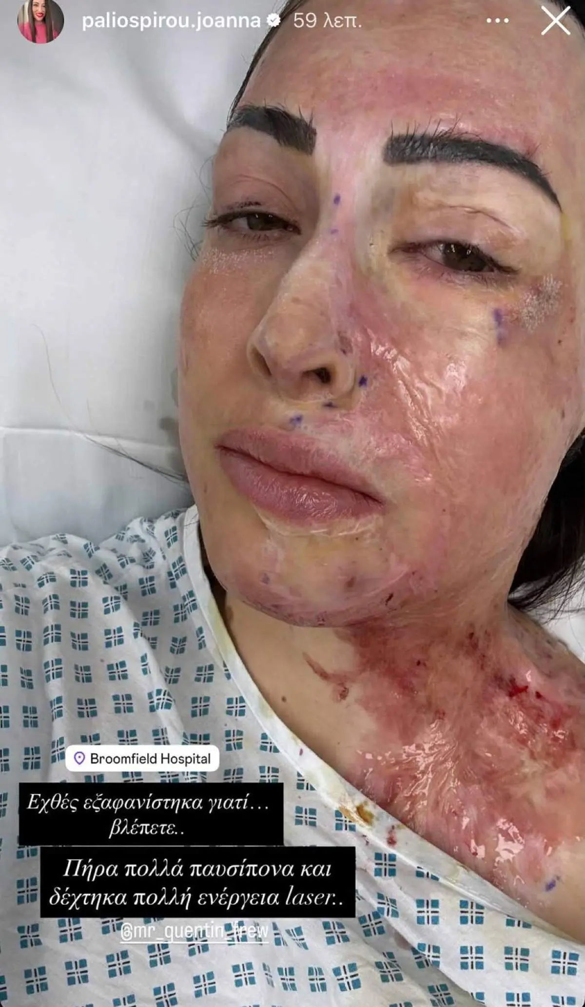 Ιωάννα Παλιοσπύρου: Δύσκολες ώρες με τις θεραπείες στο Λονδίνο – «Κατανάλωσα πολλά παυσίπονα» 3 Η Ιωάννα Παλιοσπύρου στο Instagram