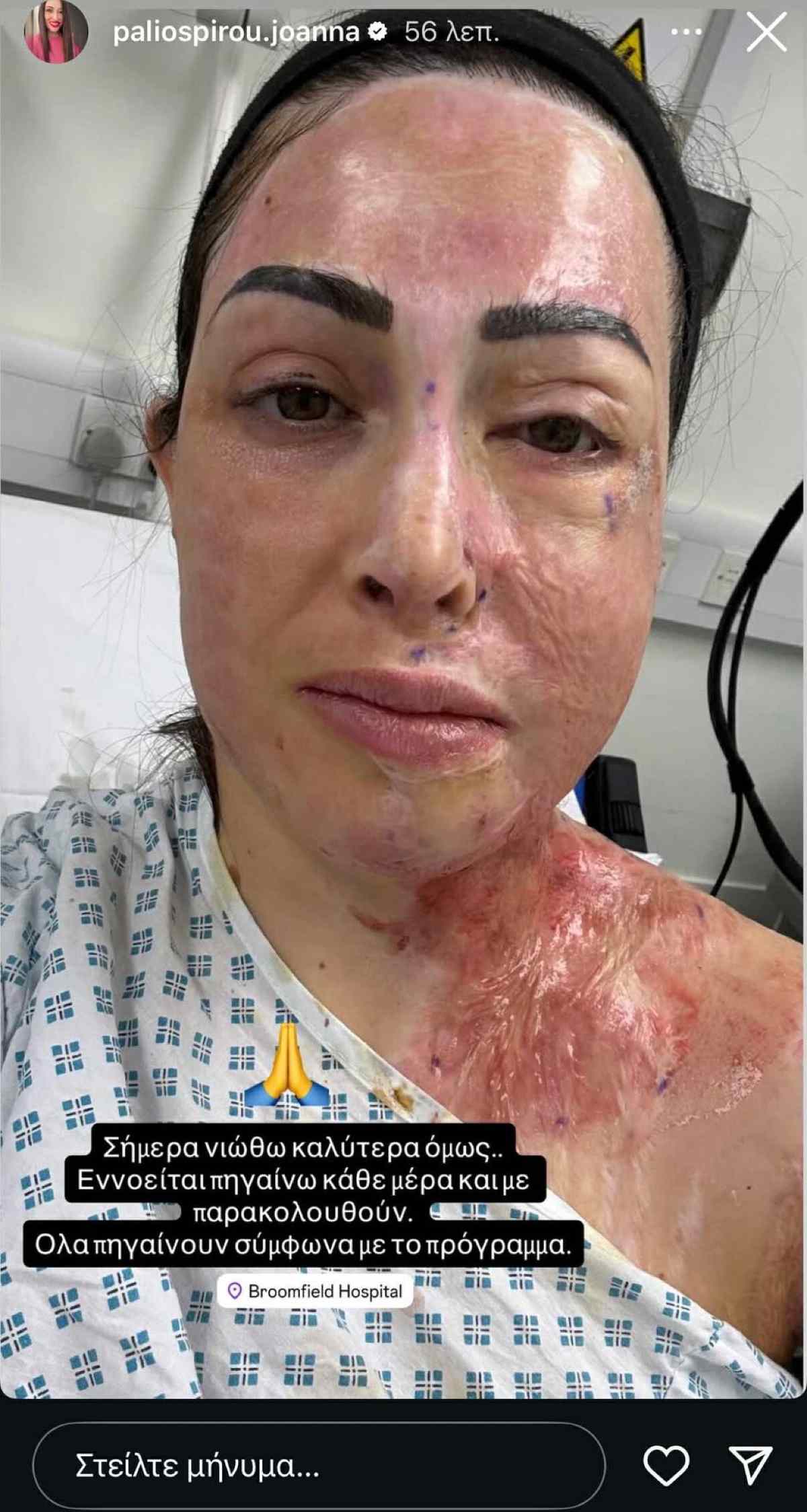 Ιωάννα Παλιοσπύρου: Δύσκολες ώρες με τις θεραπείες στο Λονδίνο – «Κατανάλωσα πολλά παυσίπονα» 4 Η Ιωάννα Παλιοσπύρου στο Instagram