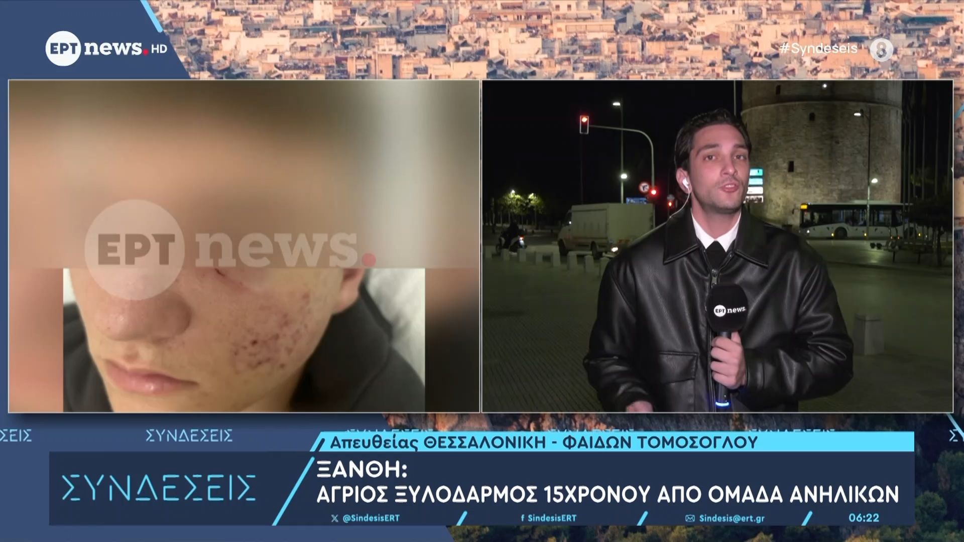 Ξάνθη: Άγριος ξυλοδαρμός 15χρονου από ομάδα ανηλίκων