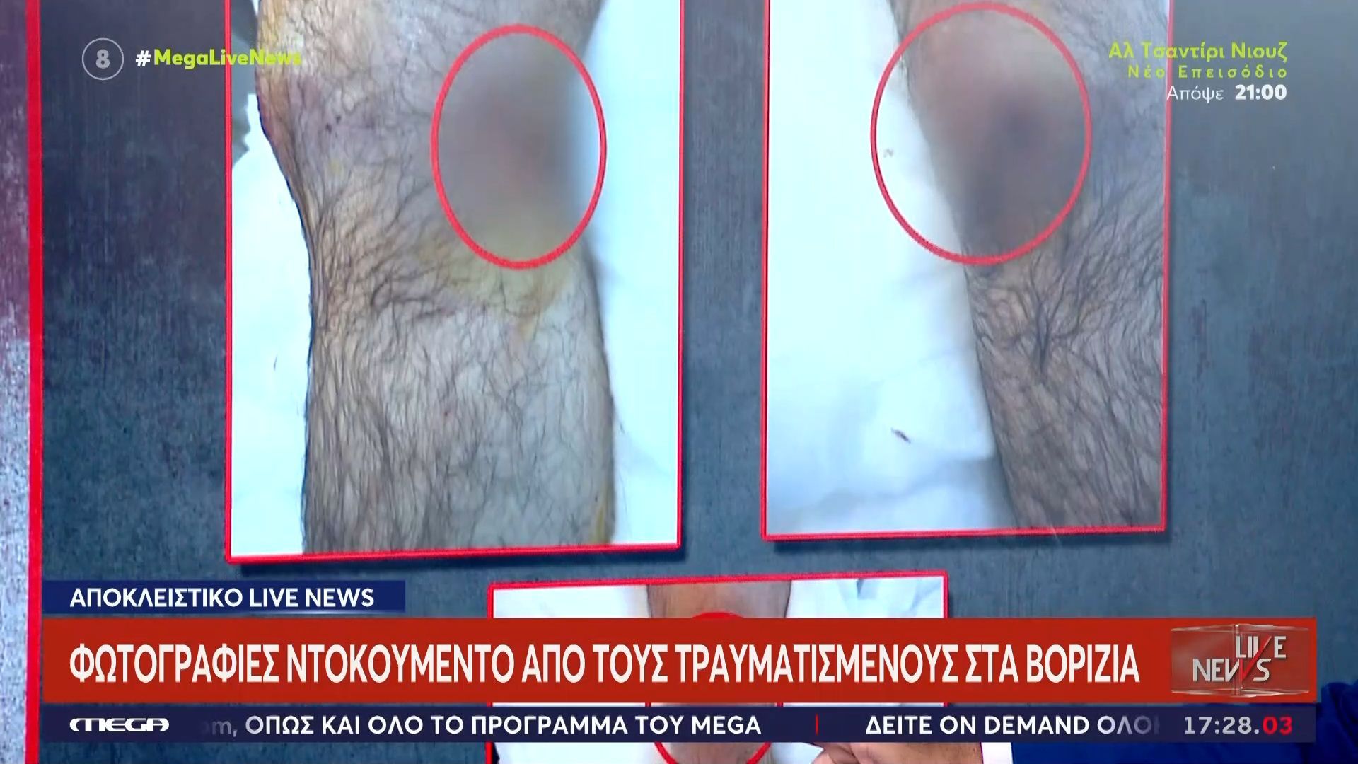 makeleio-sta-vorizia-eikones-me-toys-traymaties-meta-tin-agria-machi-1762962998