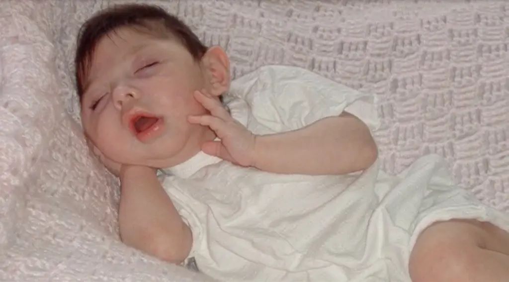 Γυναίκα που γεννήθηκε χωρίς εγκέφαλο ανέτρεψε κάθε πρόβλεψη – Από 4 χρόνια ζωής, έφτασε να γιορτάσει τα 20ά γενέθλιά της