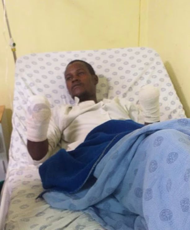 Ανατριχιαστικό περιστατικό στη Νότια Αφρική: Πάστορας ακρωτηρίασε με ματσέτα τα χέρια άνδρα για να διδάξει το «ου κλέψεις»