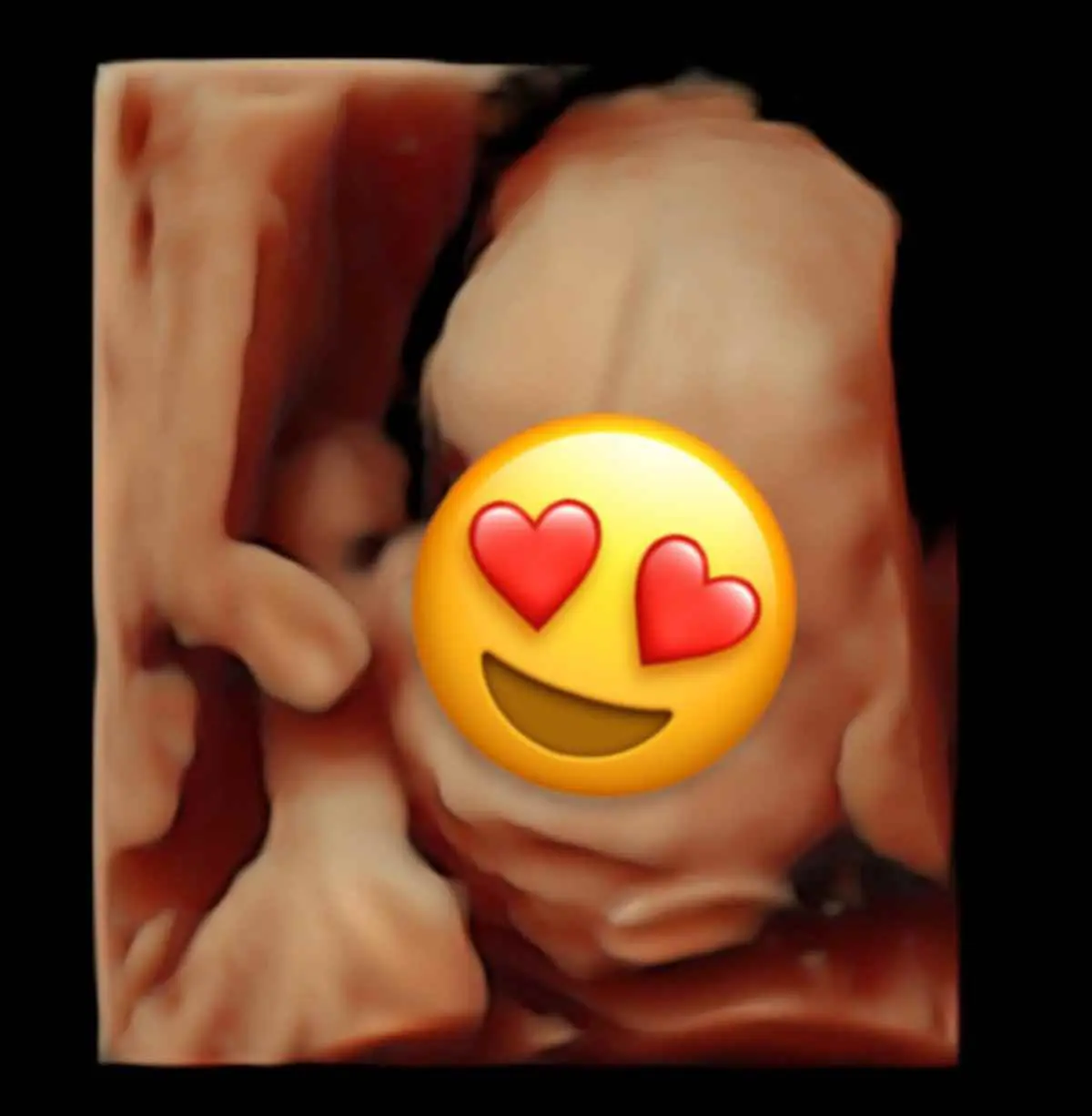 Τριγωνίδου: Μοιράστηκε εικόνες από το υπερηχογράφημα του μωρού της – «Η πιο σημαντική στιγμή της ζωής μου» 6 Το υπερηχογράφημα της Πωλίνας Τριγωνίδου