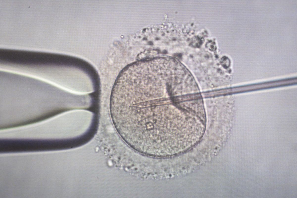 sperm-injection