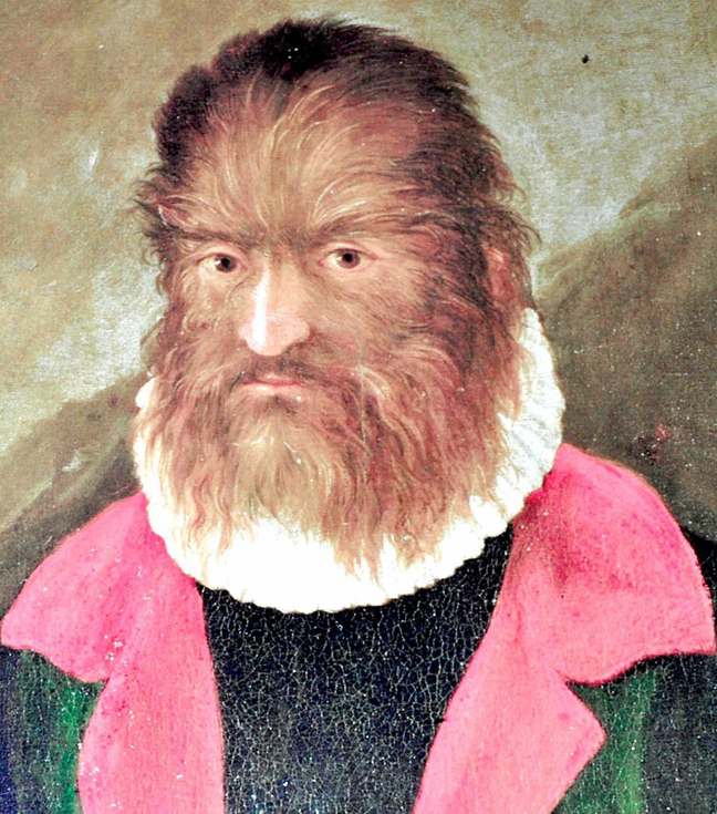 Όταν οι μύθοι για τους λυκάνθρωπους γίνονται πραγματικότητα 11 Όταν οι μύθοι για τους λυκάνθρωπους γίνονται πραγματικότητα