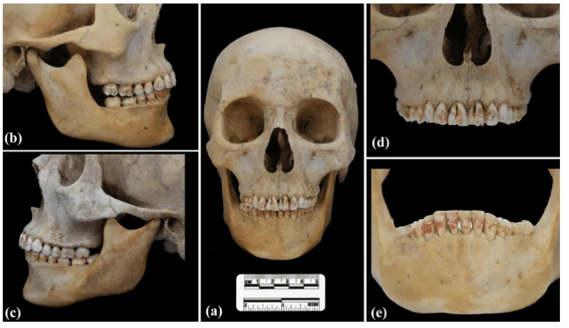 Η «Κόκκινη Πριγκίπισσα» και ο Δρόμος του Μεταξιού: Τα μυστήρια του σκελετού με τα βαμμένα κόκκινα δόντια