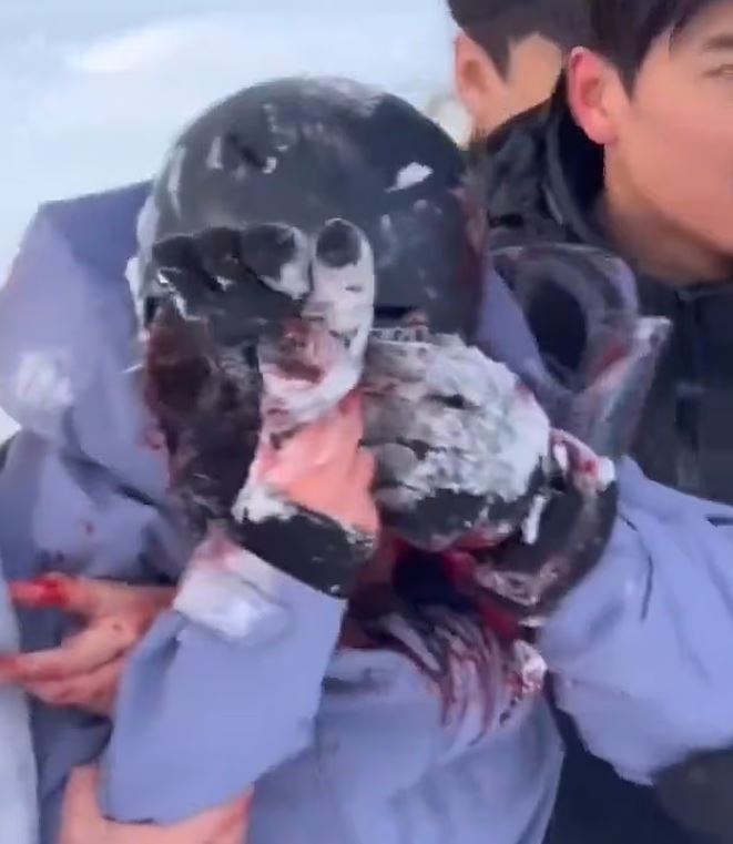 Σοκαριστικό βίντεο: Χιονισμένη λεοπάρδαλη επιτίθεται σε σκιέρ στην Κίνα – Επιχείρησε να τραβήξει selfie μαζί της