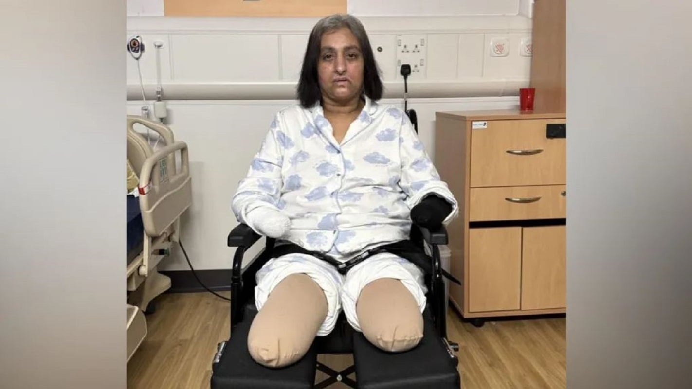 Σοκ στη Βρετανία: 56χρονη υπέστη σήψη και έχασε όλα τα άκρα της όταν σκύλος έγλειψε πληγή της