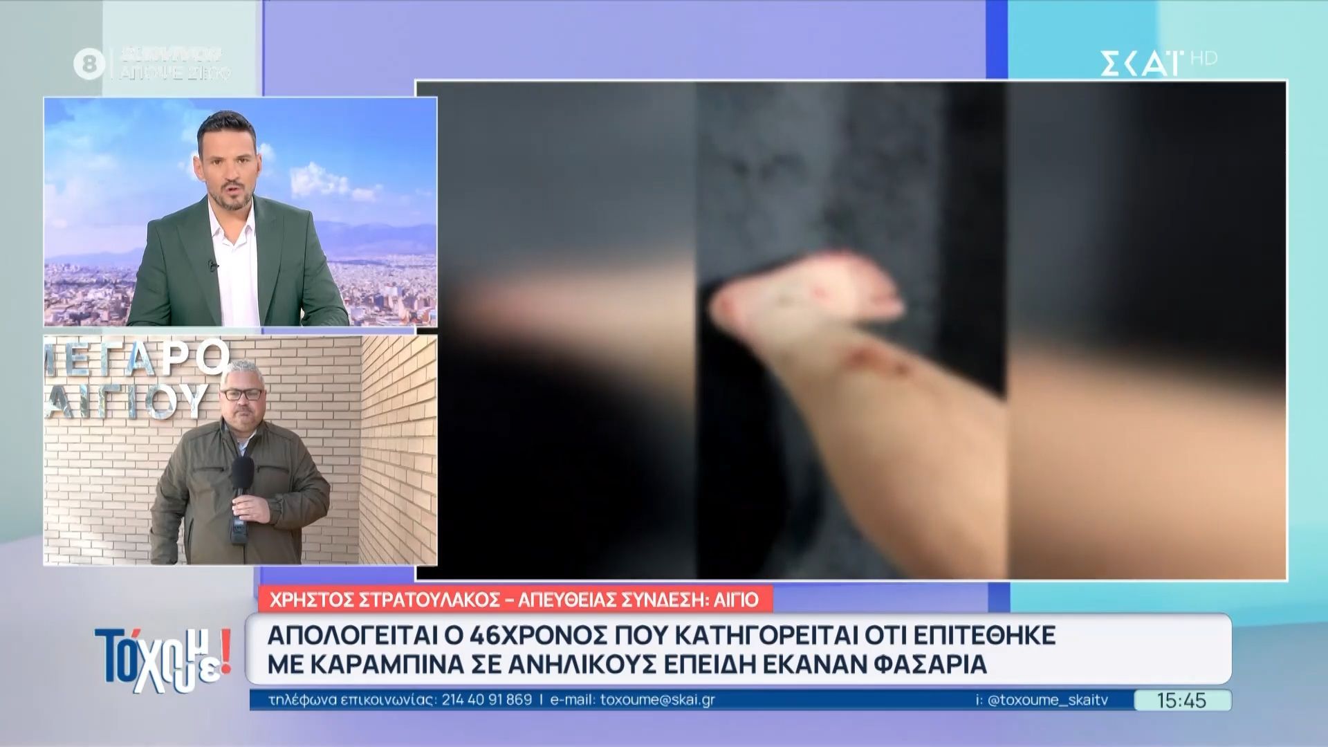 Απολογείται ο 46χρονος που κατηγορείται ότι επιτέθηκε με καραμπίνα σε ανήλικους επειδή έκαναν φασαρία