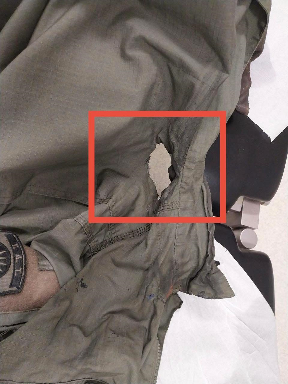 Η στολή του αστυνομικού που δέχθηκε τη βόμβα μολότοφ με αποτέλεσμα ο άνδρας της ΕΛΑΣ να υποστεί εγκαύματα σε πρόσωπο και αυχένα