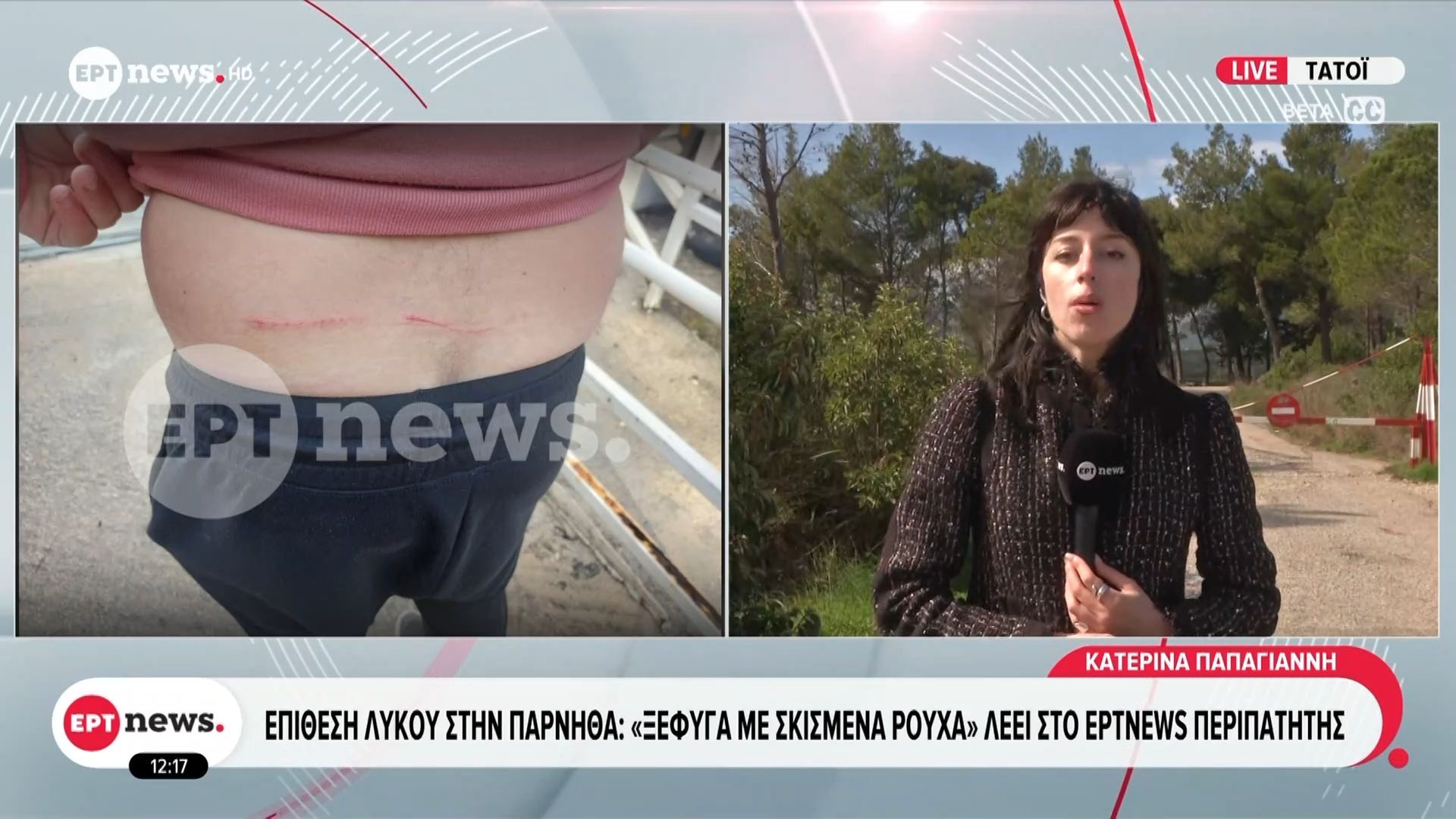 Home 65 Επίθεση λύκου στην Πάρνηθα: «Ξέφυγα με σκισμένα ρούχα» λέει στο ERTnews περιπατητής