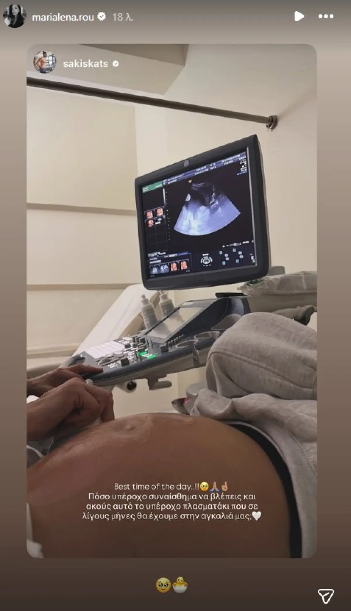 Μαριαλένα Ρουμελιώτη: Επίσκεψη στον γυναικολόγο με τον Σάκη Κατσούλη – Η συγκινητική στιγμή 2 Η Μαριαλένα Ρουμελιώτη και ο Σάκης Κατσούλης στο Instagram