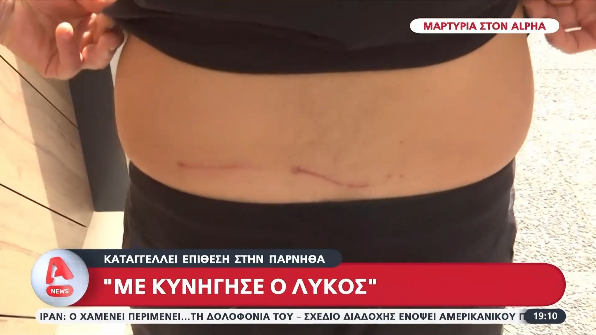 Μαρτυρία σοκ στον Alpha από άνδρα που δέχτηκε επίθεση από λύκους – «Ήταν λες και το είχε δει ως παιχνίδι»