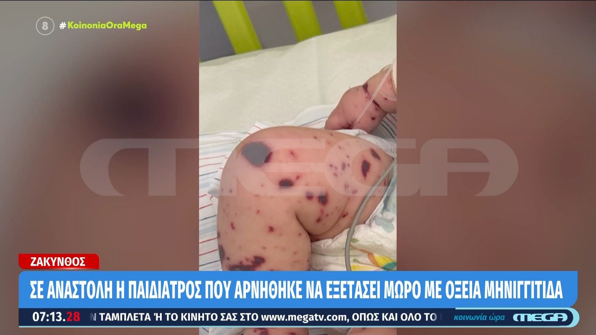 Παγώνη για Ζάκυνθο: «Δεν μπορούμε από φωτογραφίες να βγάζουμε διαγνώσεις, το περιστατικό πρέπει να εξετάζεται»