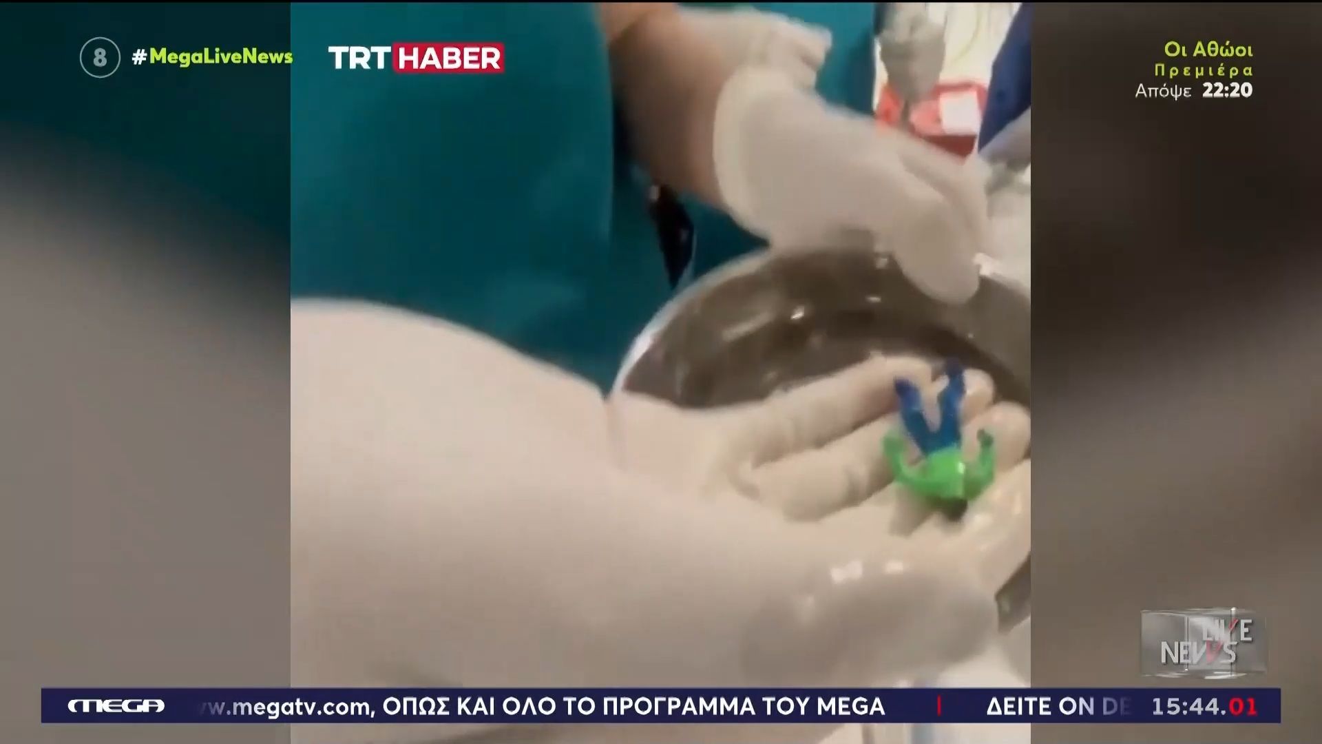 Παιδάκι 18 μηνών στην Ινδία κατάπιε τον… Hulk