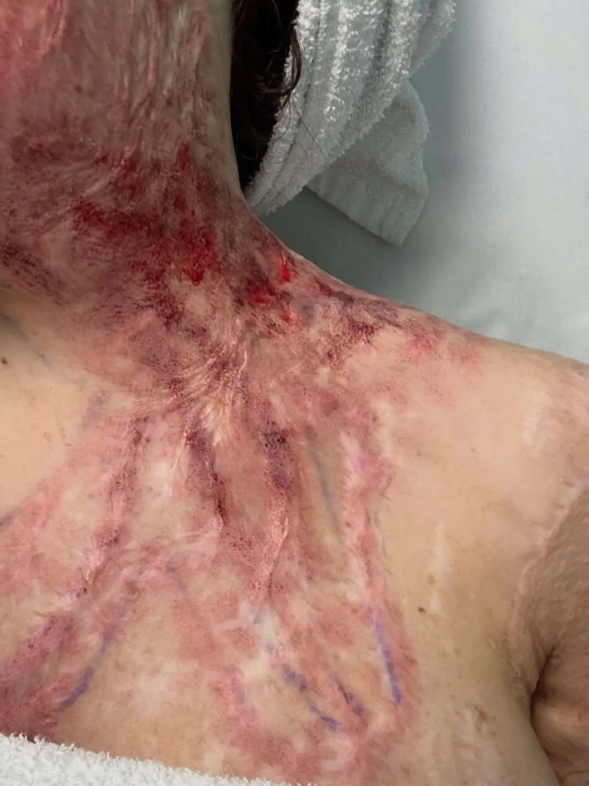 Παλιοσπύρου σημάδια