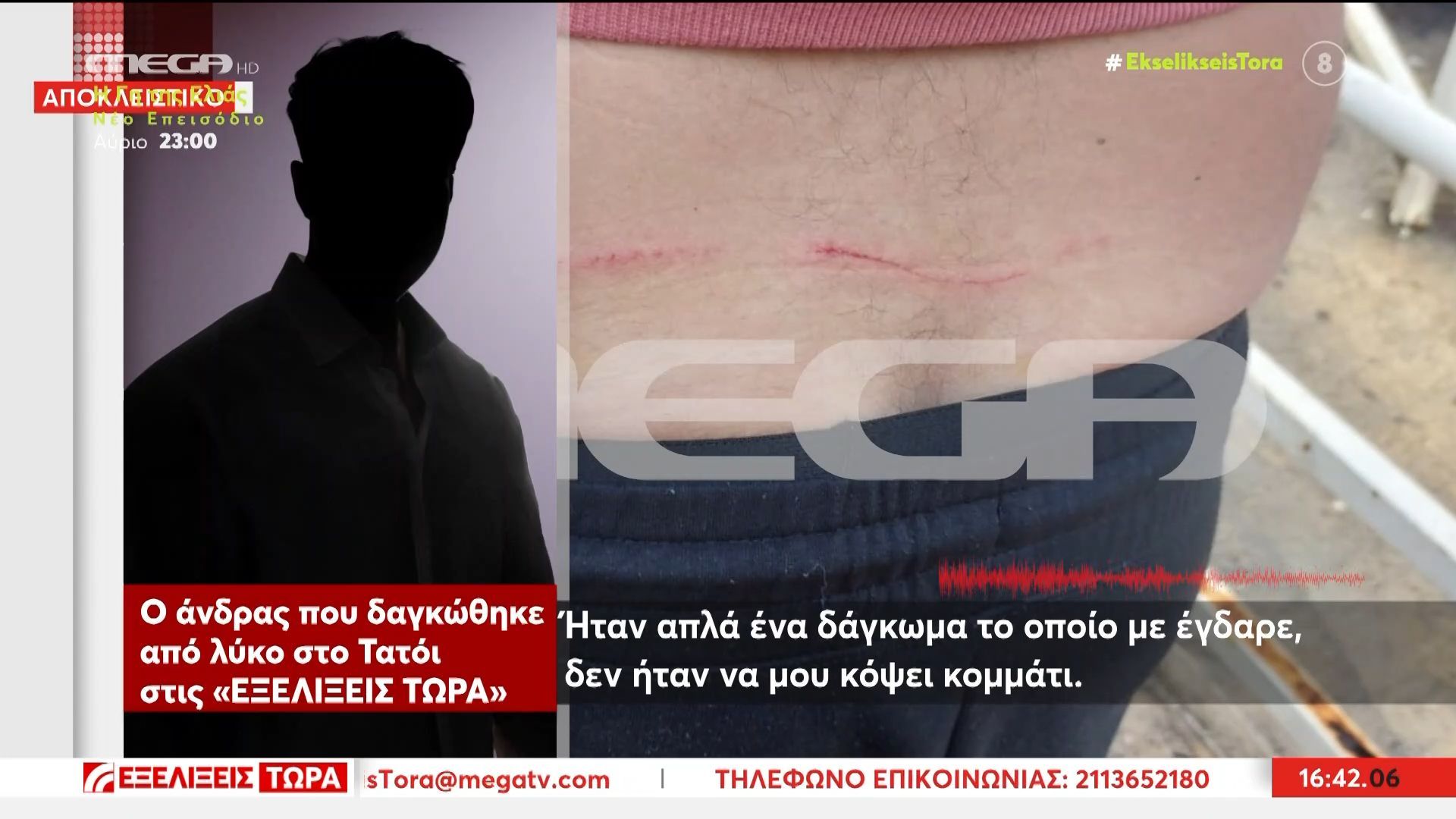 Πάρνηθα: Η επίθεση λύκου σε πολίτη που βγήκε για τρέξιμο στο Τατόι