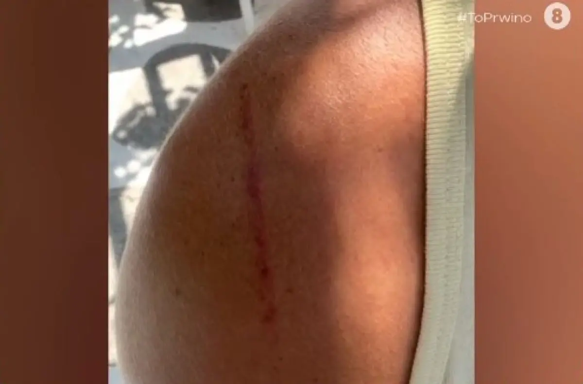 Δόξας: «Αποκτήστε το θάρρος να αναγνωρίσετε πως είστε θύματα» – Η σημαίνουσα ανάρτηση μετά τη συνέντευξη – «κόλαφος» στον Λιάγκα 5 Δόξας: «Βρείτε το θάρρος να παραδεχτείτε πως είστε θύματα» - H όλο νόημα ανάρτηση μετά τη συνέντευξη - «κόλαφο» στον Λιάγκα