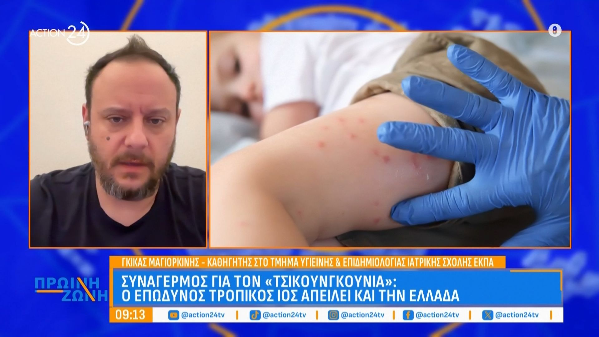 Συναγερμός για τον «Τσικουνγκούνια»: Ο επώδυνος τροπικός ιός απειλεί και την Ελλάδα
