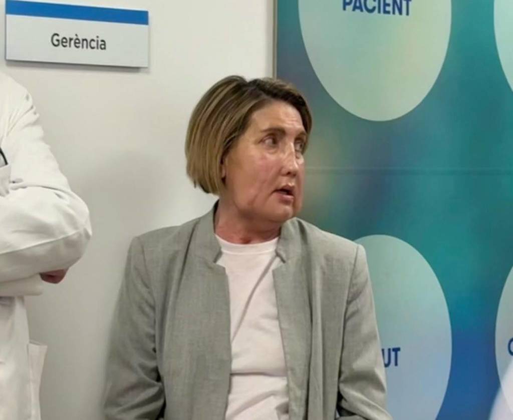 Ιατρική καινοτομία: Πραγματοποιήθηκε στην Ισπανία μεταμόσχευση προσώπου από δότρια γυναίκα που επέλεξε ευθανασία 2 Ιατρική καινοτομία: Πραγματοποιήθηκε στην Ισπανία μεταμόσχευση προσώπου από δότρια γυναίκα που επέλεξε ευθανασία