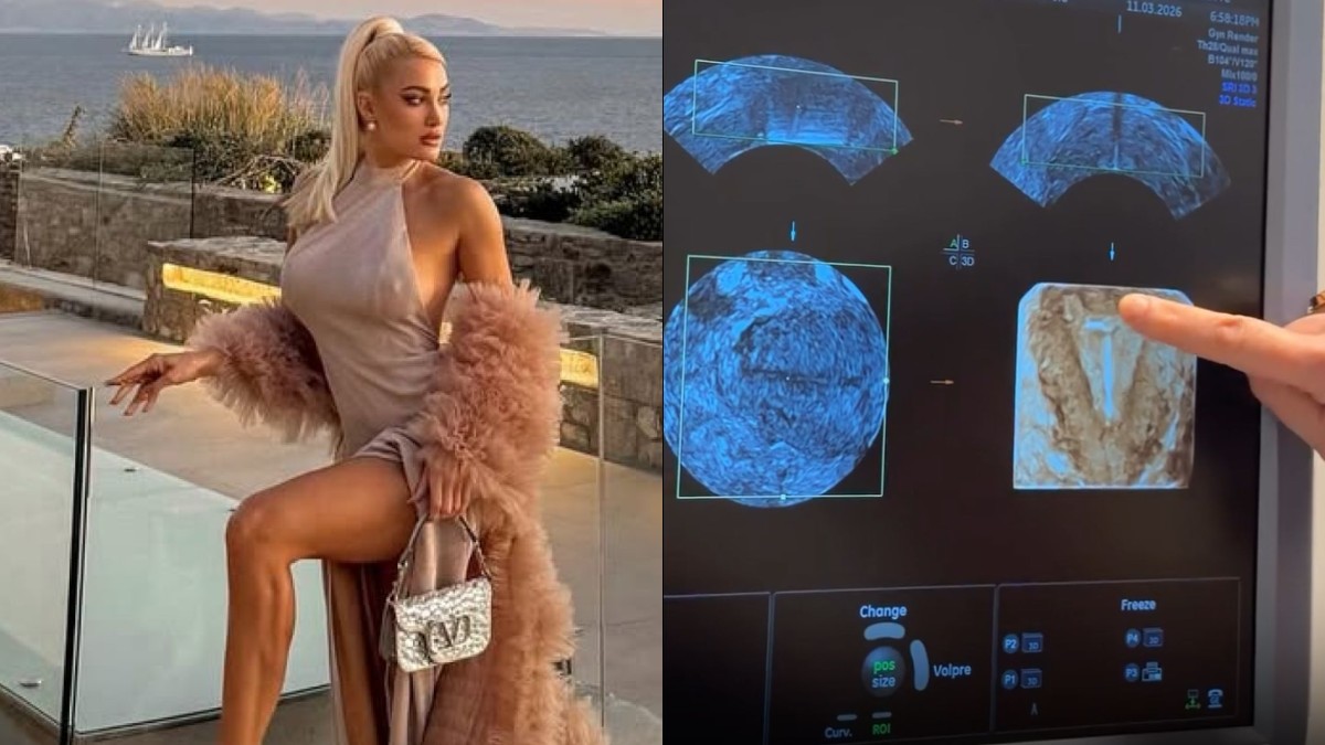 Ιωάννα Τούνη: Παρουσίασε τον υπέρηχο και προκάλεσε αναστάτωση – Η αντίδρασή της στις φήμες εγκυμοσύνης