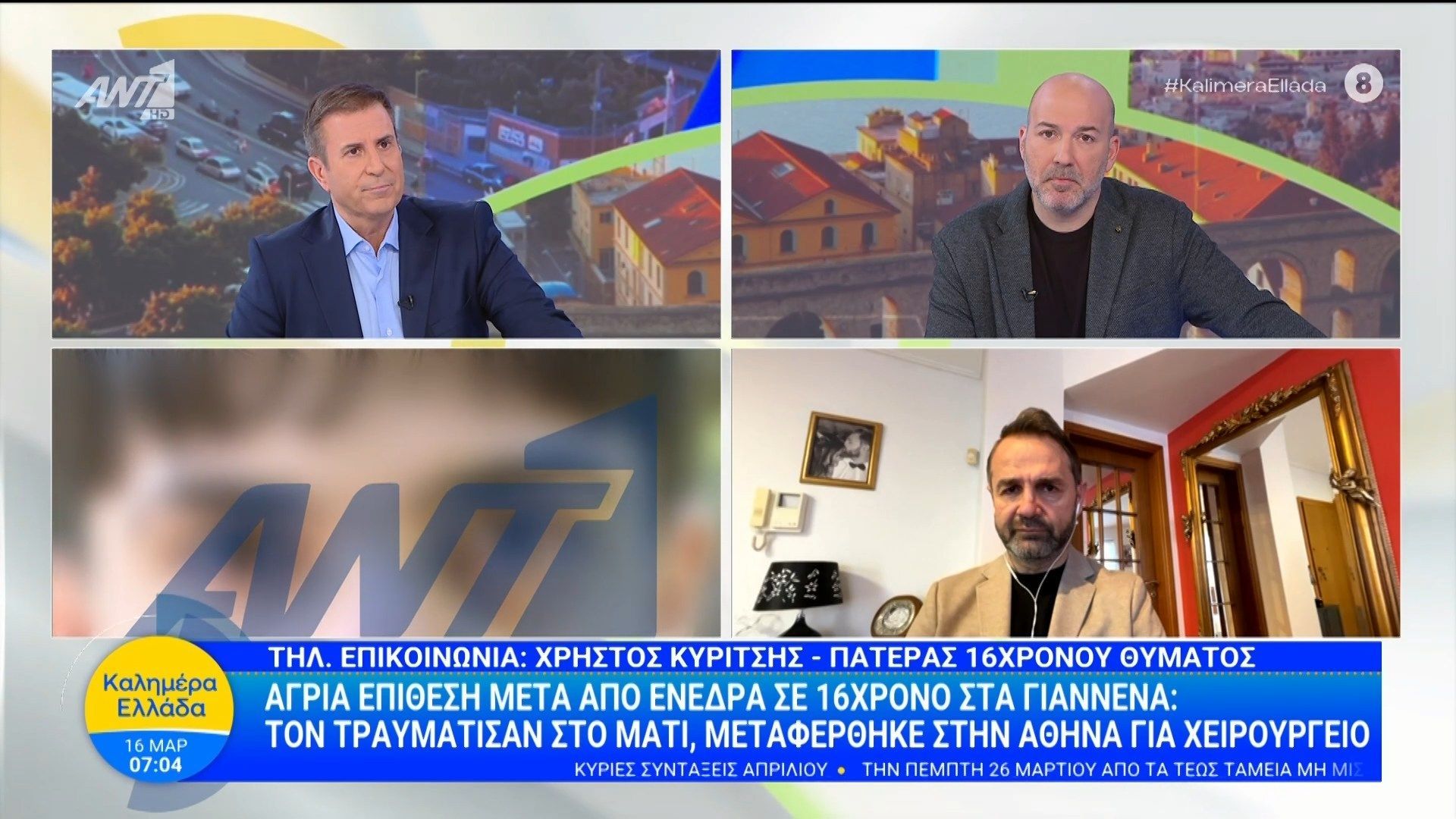 Άγρια επίθεση μετά από ενέδρα σε 16χρονο στα Γιάννενα – Καλημέρα Ελλάδα – 16/03/2026