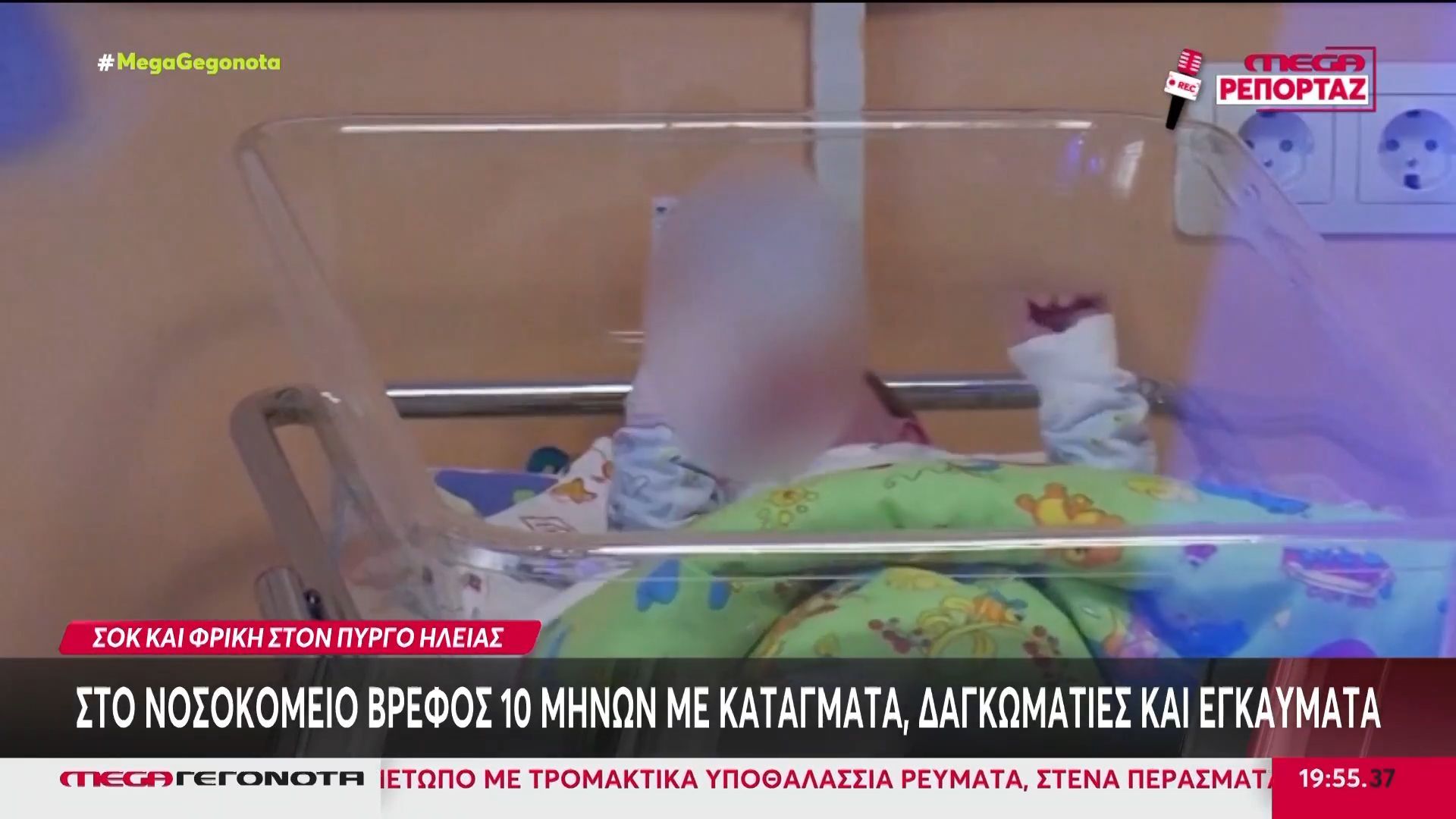 Πάτρα: Στο νοσοκομείο βρέφος με κατάγματα, δαγκωματιές & εγκαύματα – Τι εξετάζεται