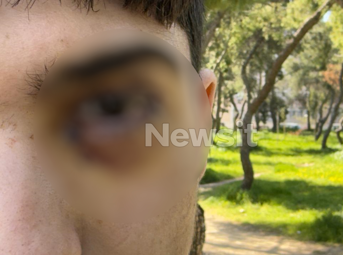 16χρονος στα Ιωάννινα