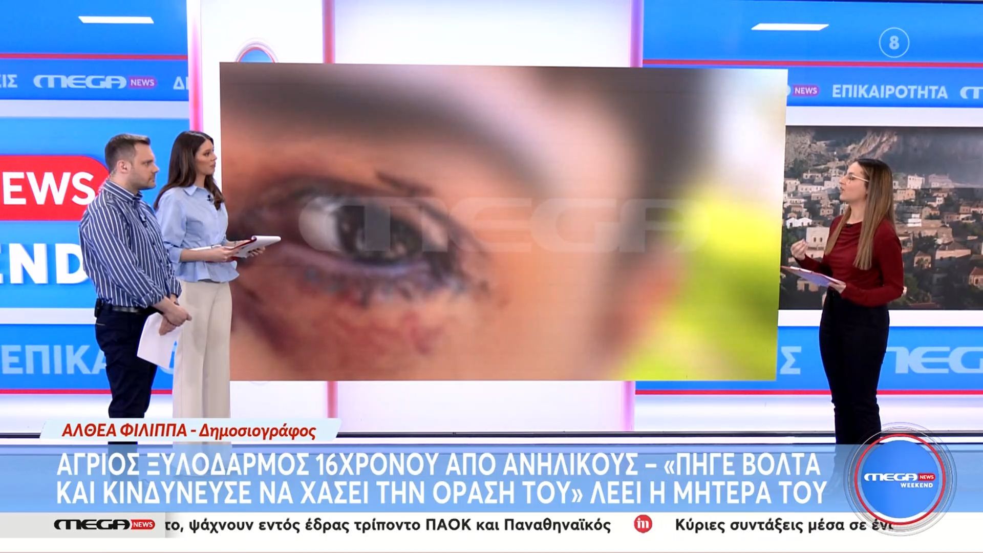 Ιωάννινα: Άγριος ξυλοδαρμός 16χρονου από ανήλικους – «Πήγε βόλτα και κινδύνευσε να χάσει την όρασή του» λέει η μητέρα του