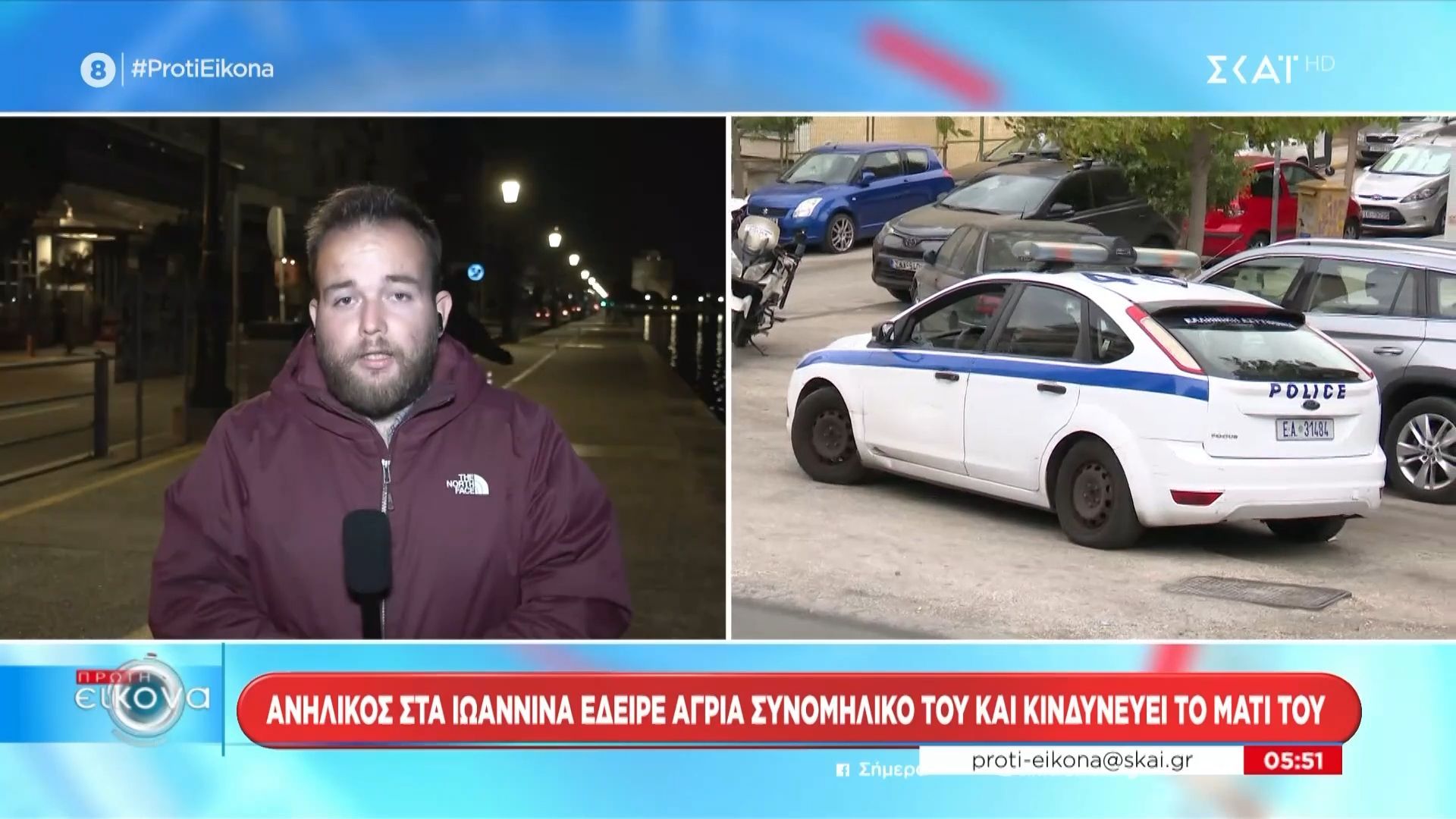 Ιωάννινα: Ανήλικος έδειρε άγρια συνομήλικό του – Κινδυνεύει να χάσει το μάτι του